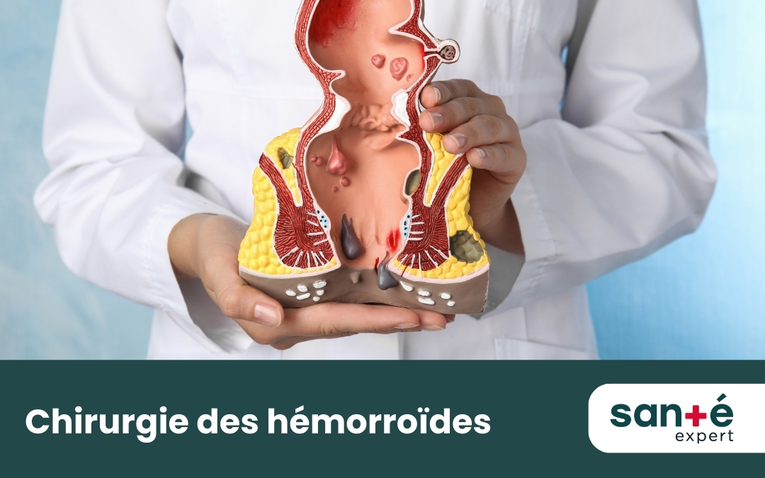 Chirurgie hémorroïdes privée: Hémorroïdectomie à Québec