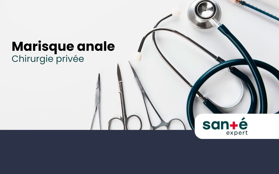 Marisque anale: Chirurgie privée à Québec