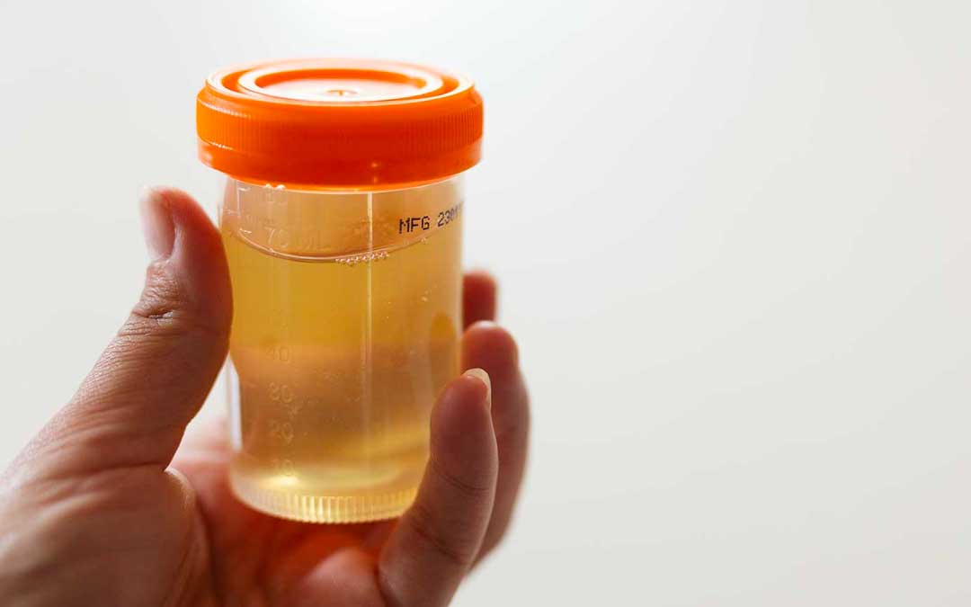 Combien de temps dure une infection urinaire sans traitement​?