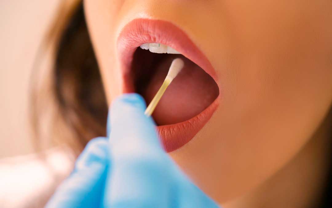 Où passer un test de streptocoque​ à Québec? Chez Santé Expert!