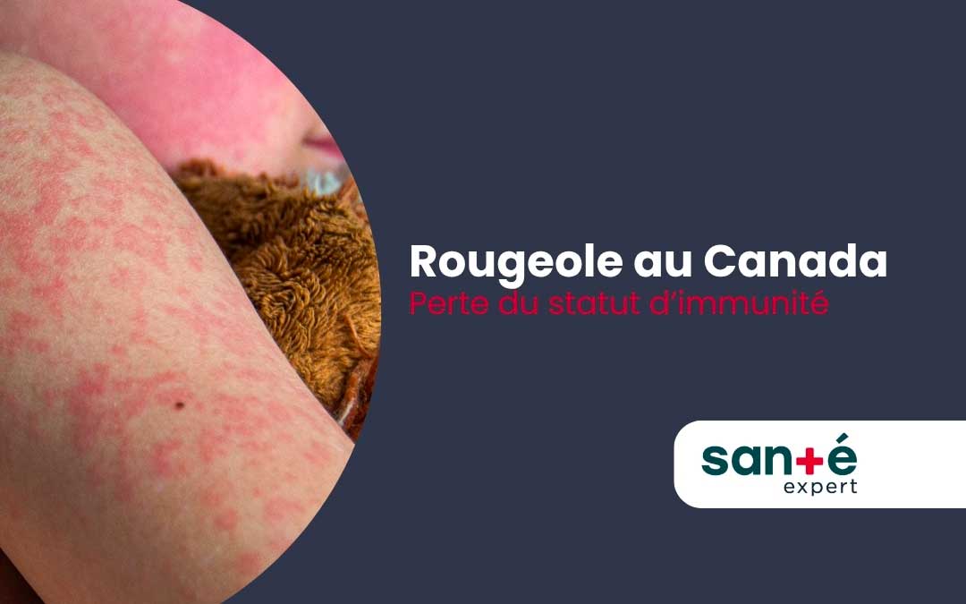 Perte du statut d’élimination de la rougeole au Canada