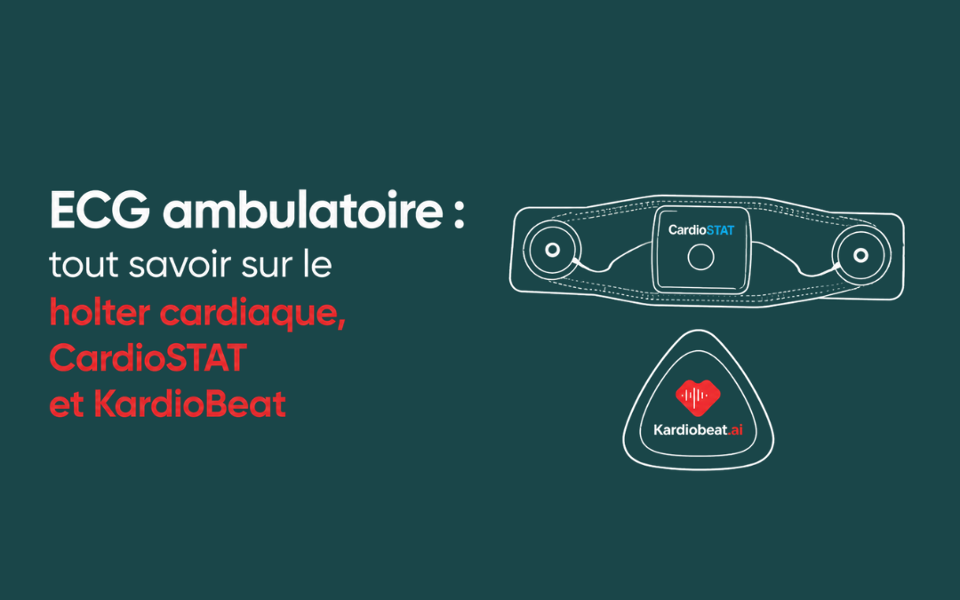 ECG ambulatoire : tout savoir sur le holter cardiaque, CardioSTAT et KardioBeat